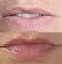 Micropigmentação labial em figueira da foz - Antes e depois
