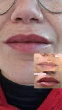 Micropigmentação labial em figueira da foz - Antes e depois