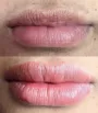 Micropigmentação labial em figueira da foz - Antes e depois