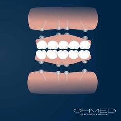 OHMED - Oral Health and Medicine