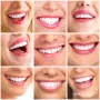 Estetica Dentaria